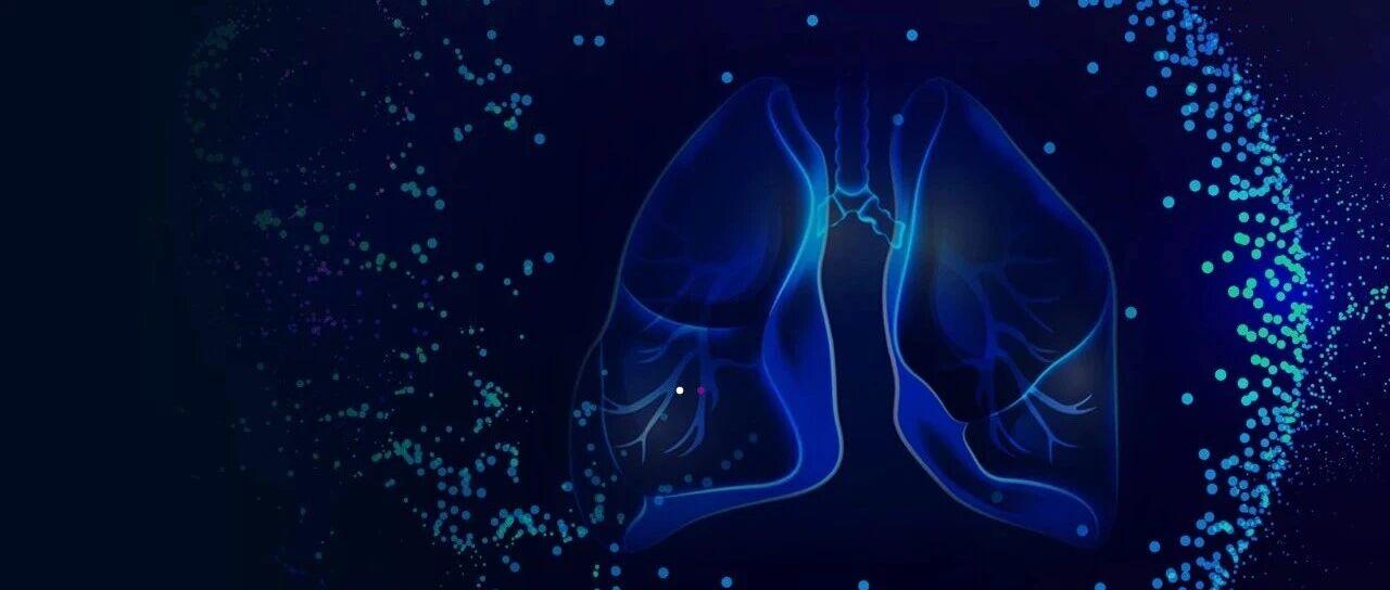 resize,m_fill,h_272,w_448,limit_0